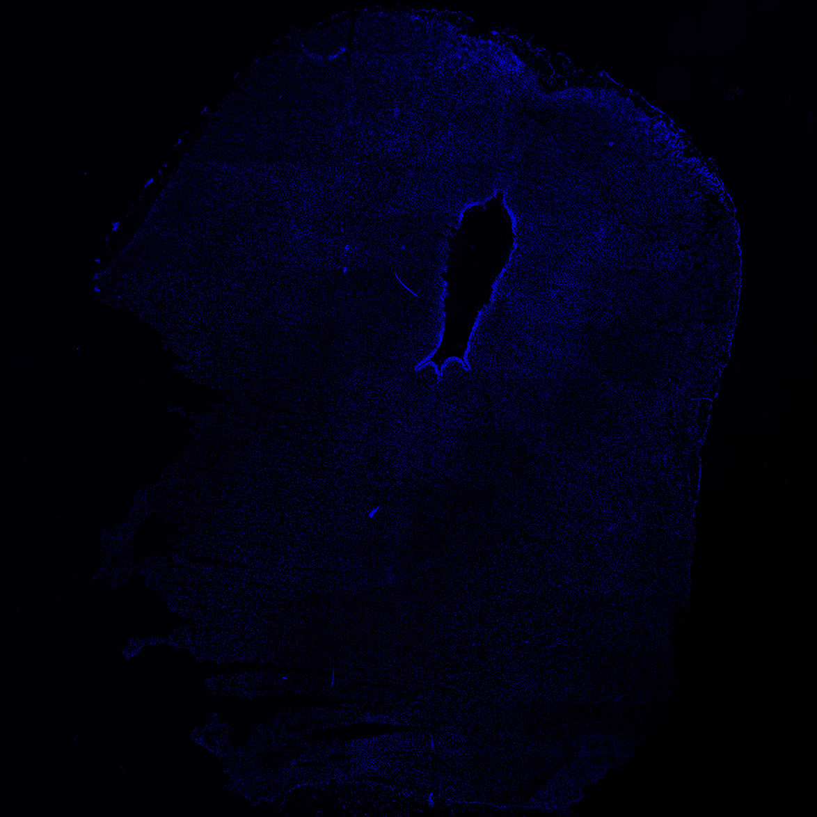 Human foetal midbrain